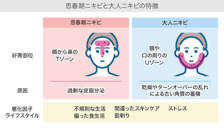 思春期ニキビと大人ニキビの特徴