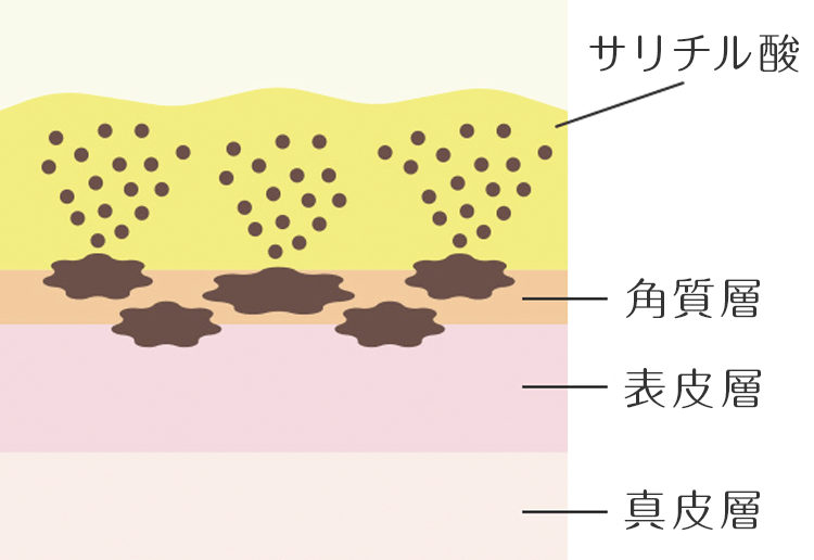 サリチル酸マクロゴール