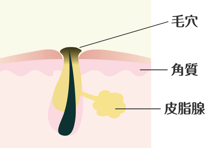 黒ニキビ 毛穴の状態