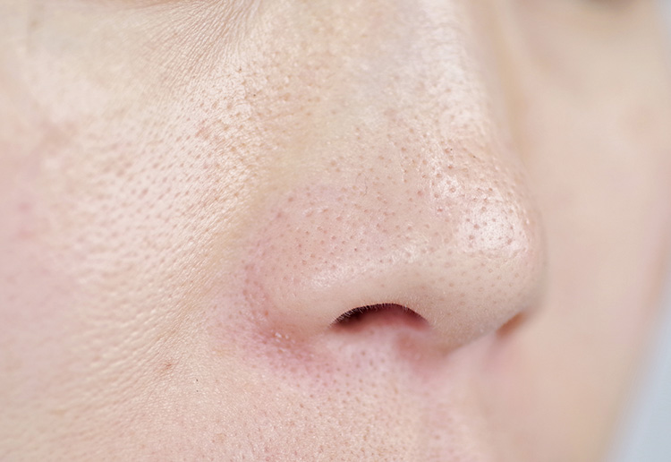 毛穴の引き締め効果