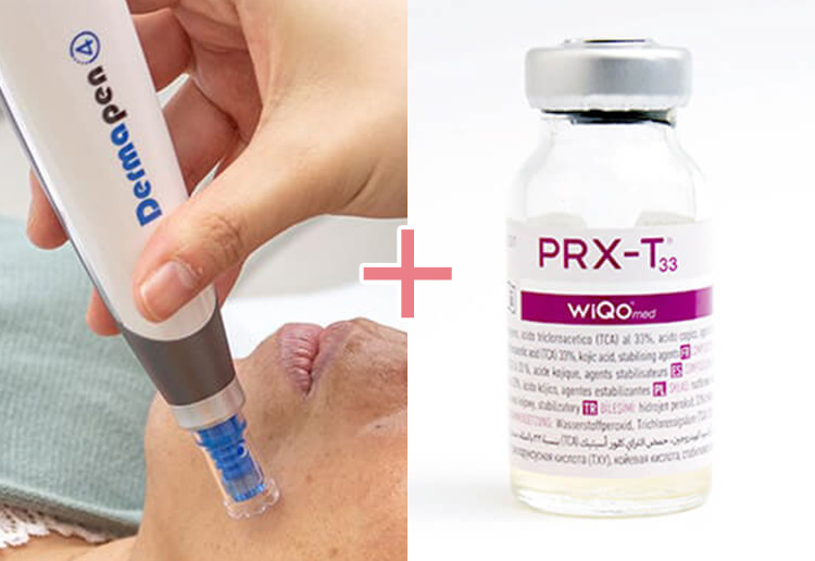 ヴェルベットスキン