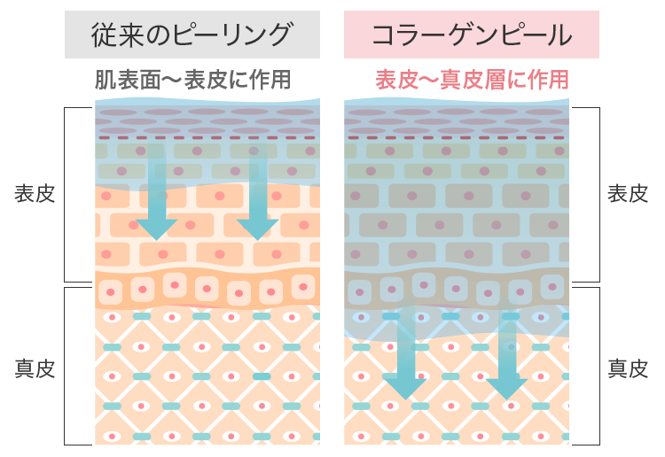 マッサージピール（コラーゲンピール）