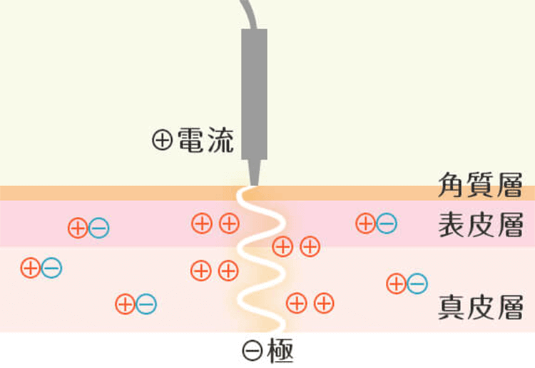 スティッロで電気を導入