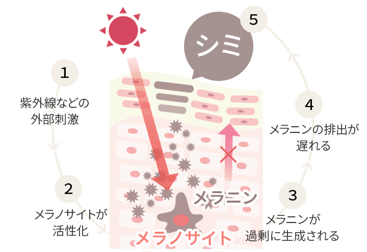 シミができるメカニズム