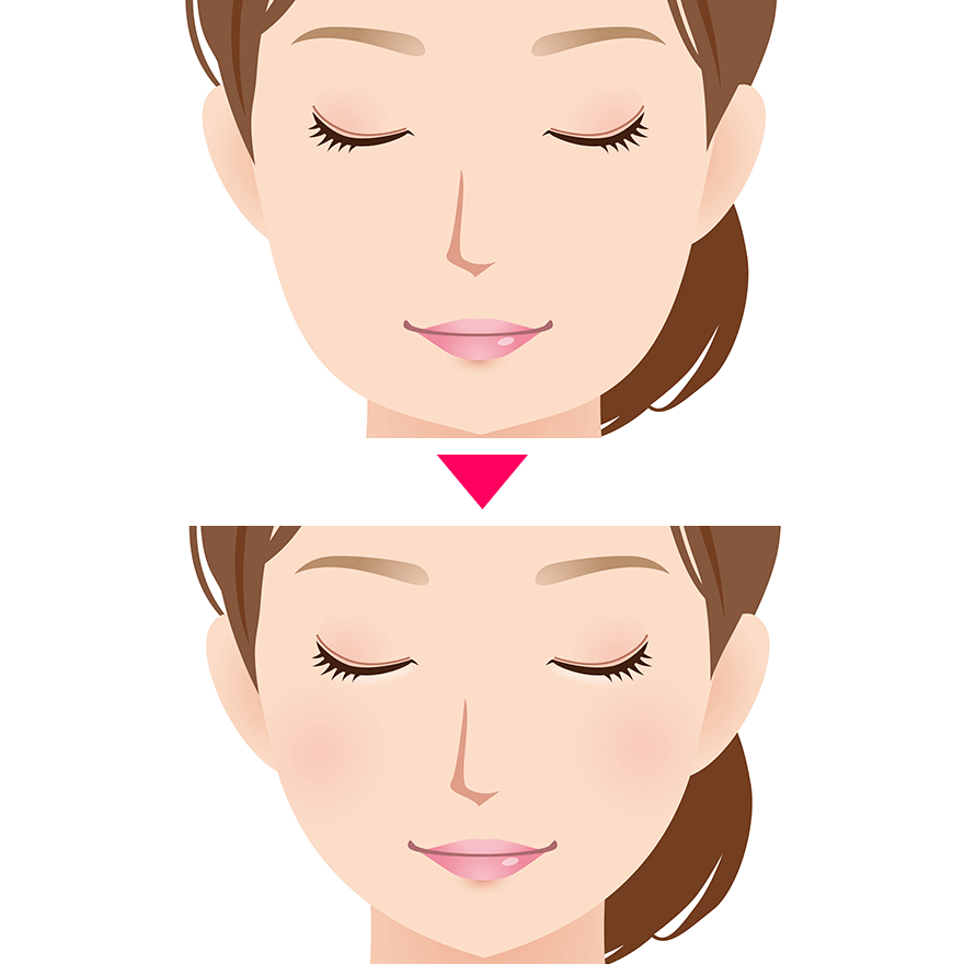 エラボトックス