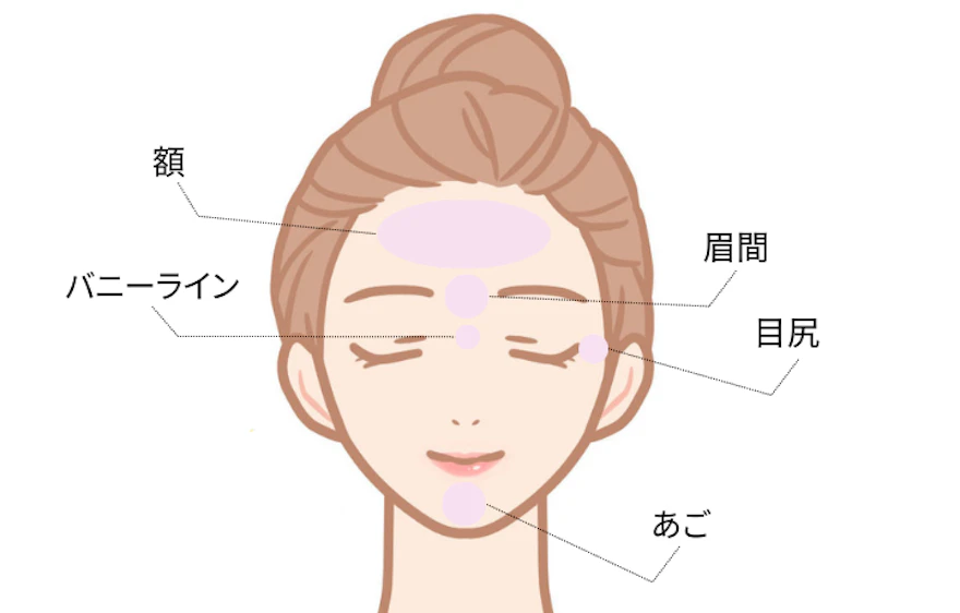 表情じわの改善と予防