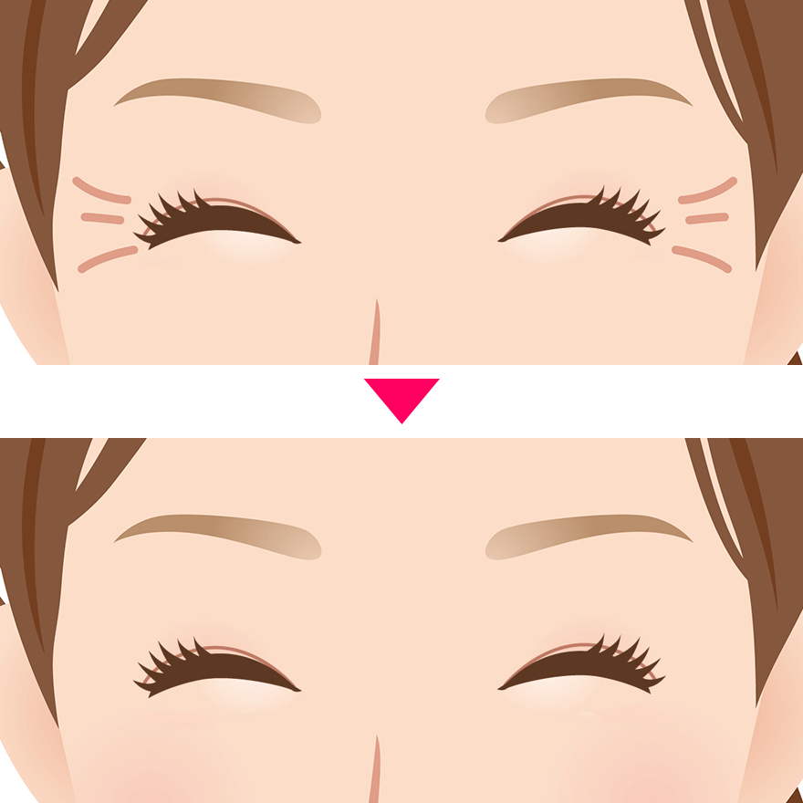 目尻の笑いじわ