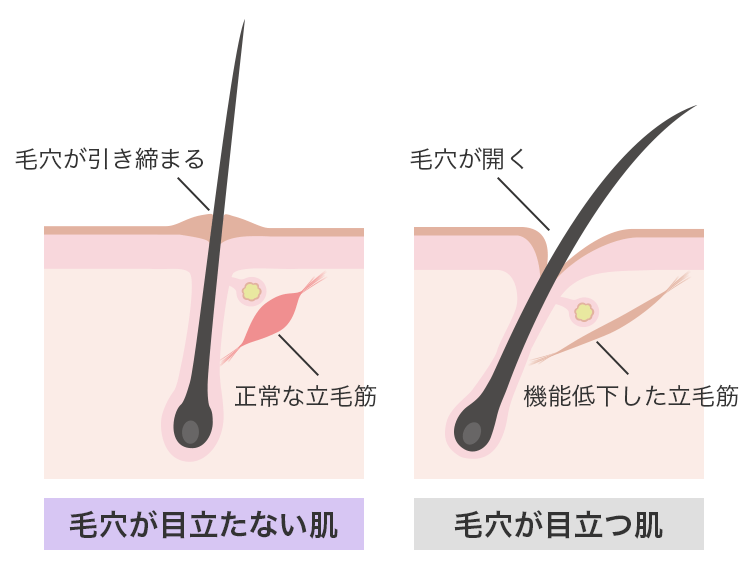 正常な「立毛筋」と機能低下した「立毛筋