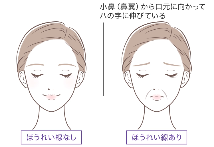 ほうれい線とは