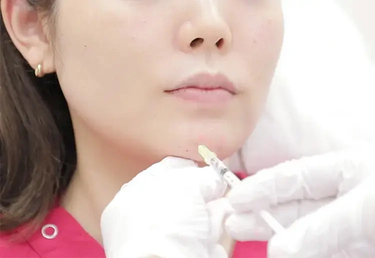 自然な仕上がり