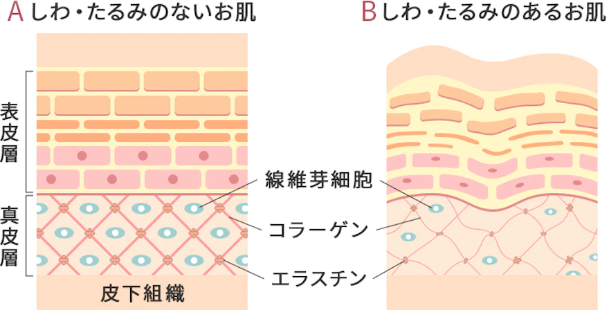 加齢による肌の弾力低下