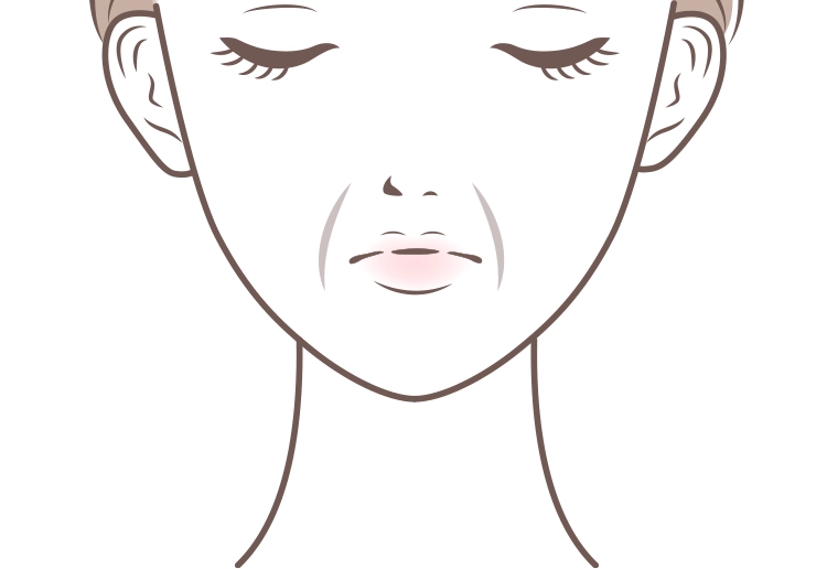 皮膚のたるみタイプ