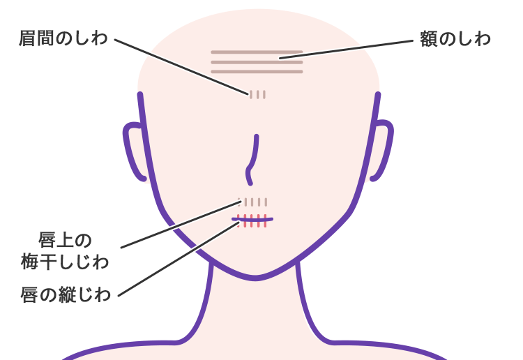 しわ