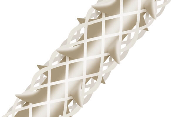 テスリフト（TESSLIFT）