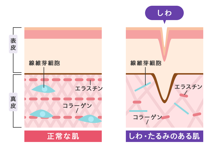 しわ・たるみの原因