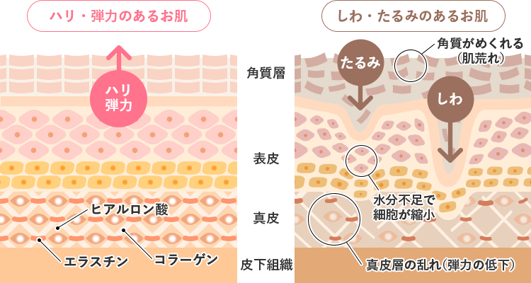 しわ・たるみができるメカニズム